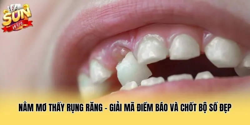 Nằm Mơ Thấy Rụng Răng - Giải Mã Điềm Báo Và Chốt Bộ Số Đẹp